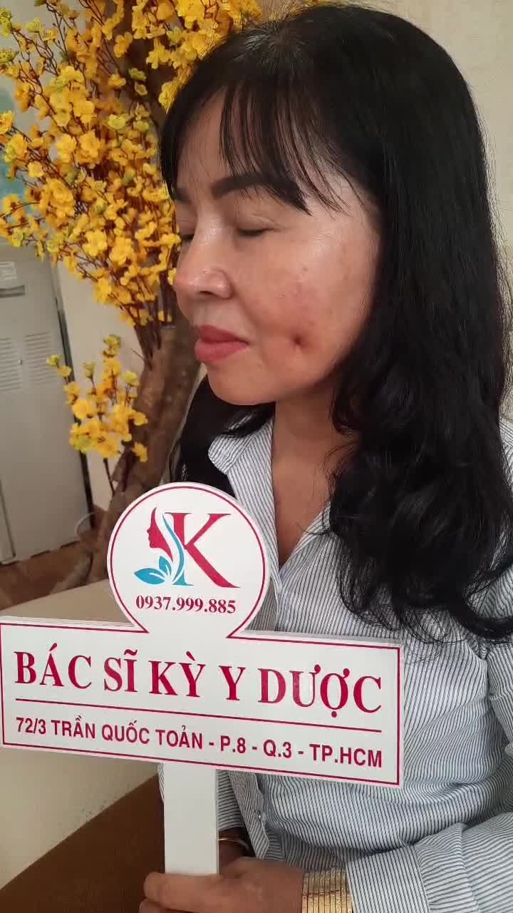 Cắt Má Lúm Đồng Tiền