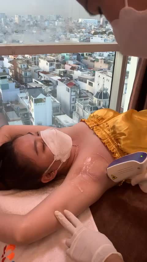Quy trình triệt lông nách công nghệ Diode laser của khách hàng lần thứ 4.