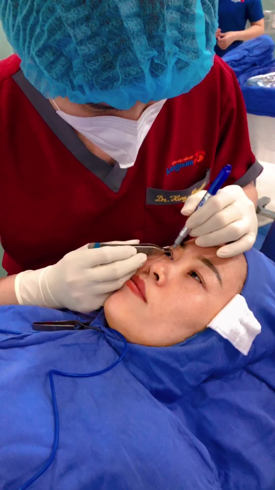 Bác sĩ tư vấn quá trình đo vẽ cắt mí Extra Plasma