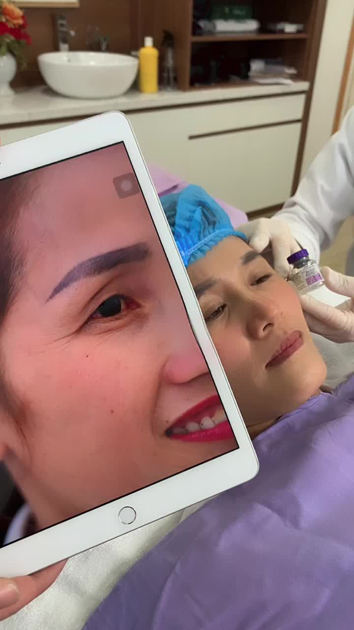 Vượt 80km từ Hà Tĩnh đến Nghệ An tiêm Botox XOÁ NHĂN MẮT