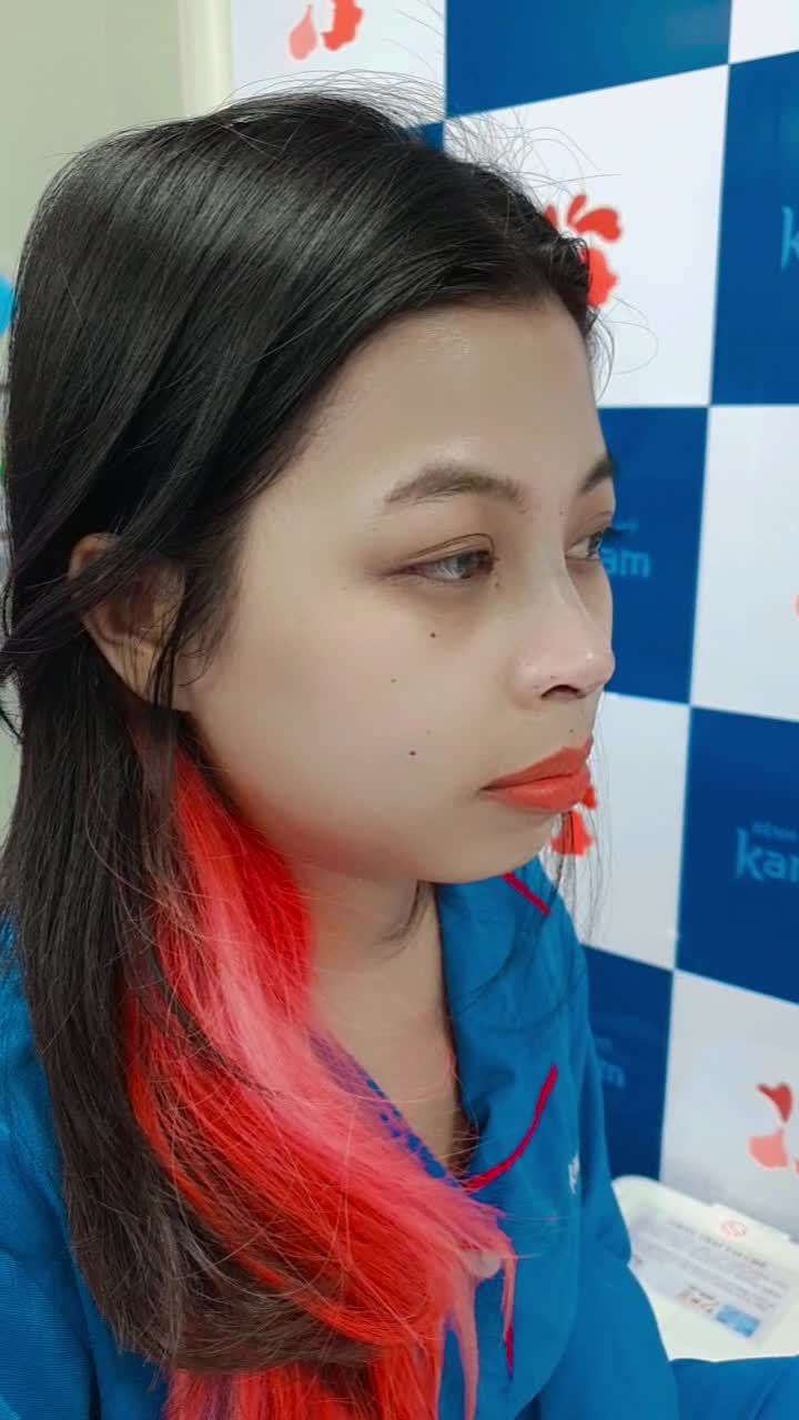 Nâng mũi khi đang đeo niềng có được không