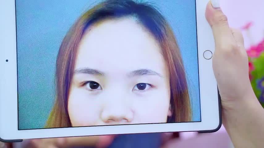Mí mắt gặp nhiều khuyến điểm bạn chỉ cần trao niềm tin Dr.Hải Lê sẽ trao cho bạn sự tự tin