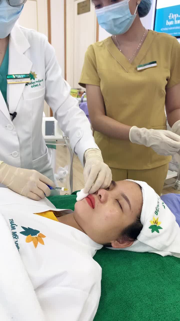 Tiêm Chất làm đầy rãnh cười tại Đông Á Nghệ An