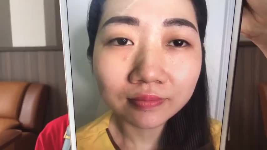 Nếu bạn đang có ý định thực hiện Cắt mí tại Dr.Hải Lê cơ sở HCM thì nhất định không thể bỏ qua video này!