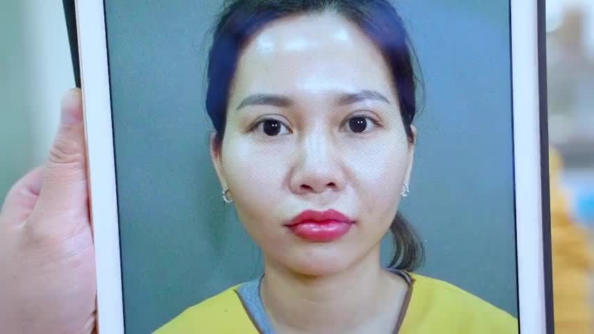 Mí mắt hỏng đến mức độ nào Dr.Hải Lê đều có thể giúp bạn sở hữu đôi mắt đẹp như mong muốn