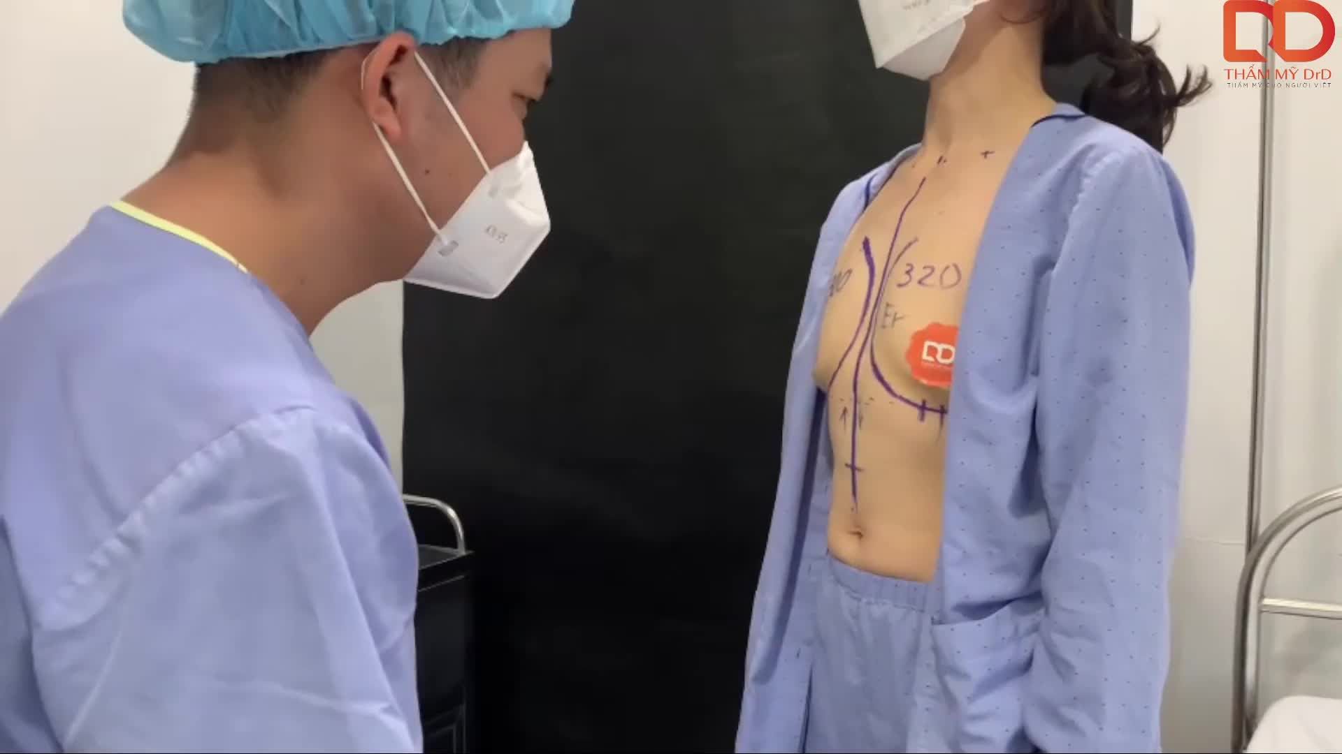 Khách hàng gặp phải tình trạng teo tuyến vú sau sinh, ngực lệch nhau về thể tích, lồng ngực tương đối hẹp.