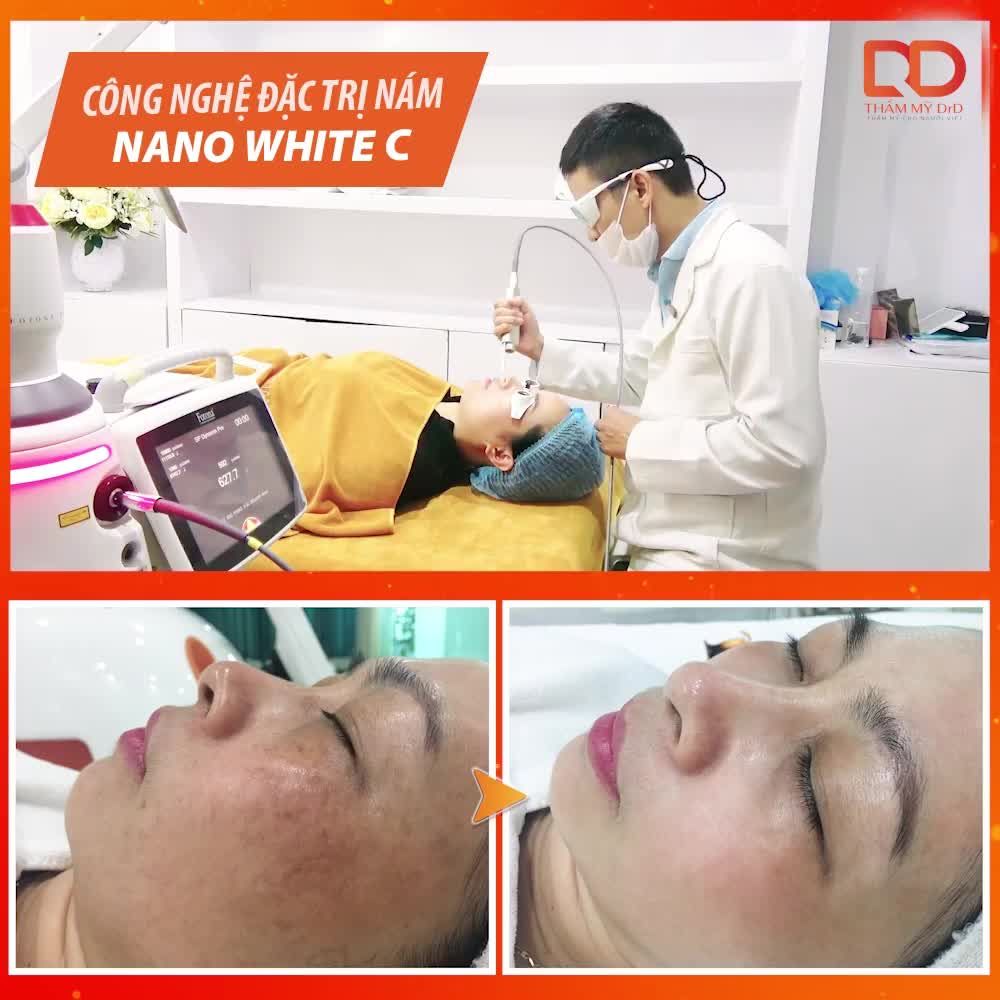 THỜI ĐIỂM VÀNG TRỊ NÁM - CHỌN CÔNG NGHỆ NANO WHITE C TẠI SAO