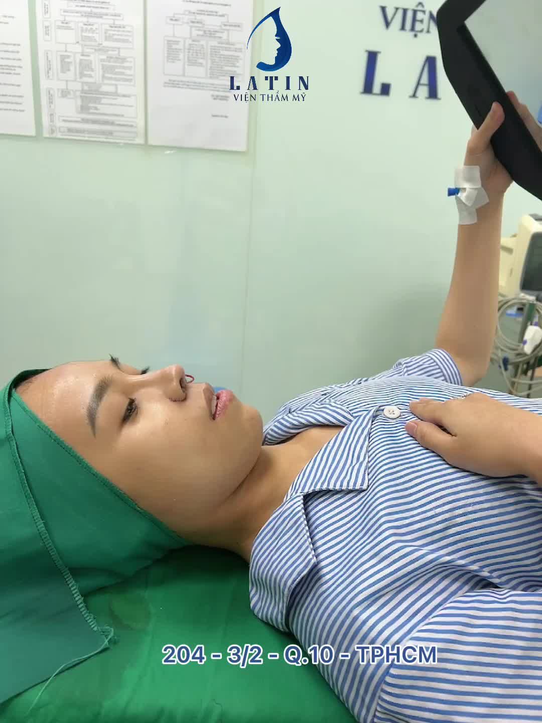 CẬN CẢNH chị khách hàng cực ưng ý với chiếc mũi vừa PT xong