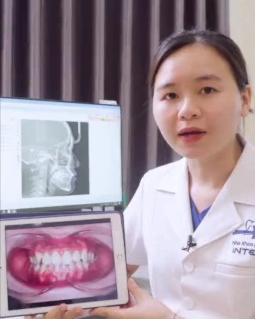 TƯ VẤN KẾ HOẠCH ĐIỀU TRỊ TRƯỜNG HỢP CHEN CHÚC, KHẤP KHỂNH 2 HÀM