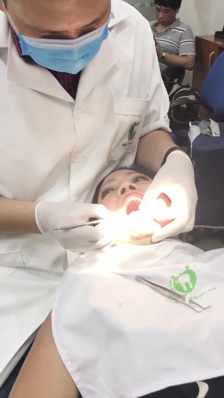 GẮN CỐ ĐỊNH RĂNG SỨ CHO NỮ KHÁCH HÀNG CÓ GƯƠNG MẶT PHÚC HẬU