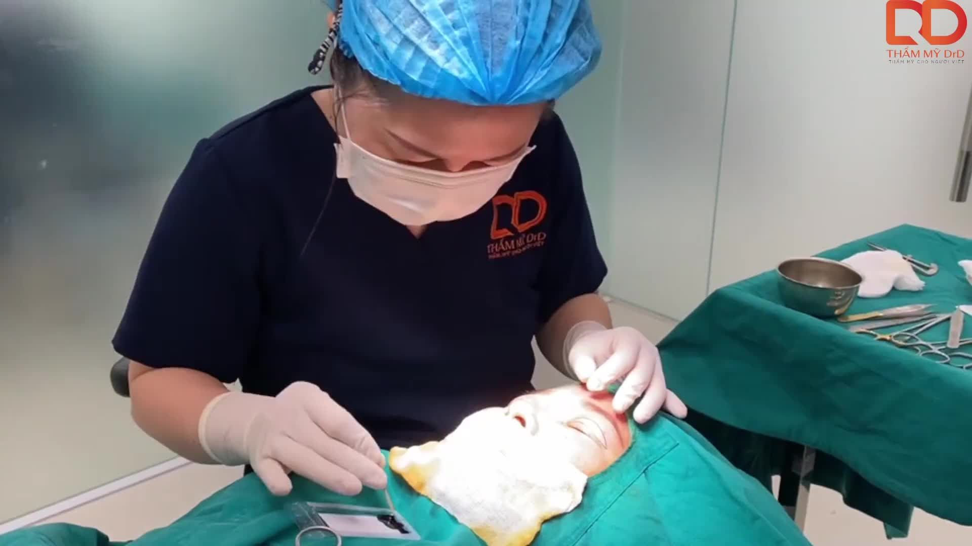 Khách hàng từng gặp phải tình trạng liệt cơ thần kinh mặt, mí mắt sụp, nhiều da thừa, 2 bên mí mắt to nhỏ khách nhau.