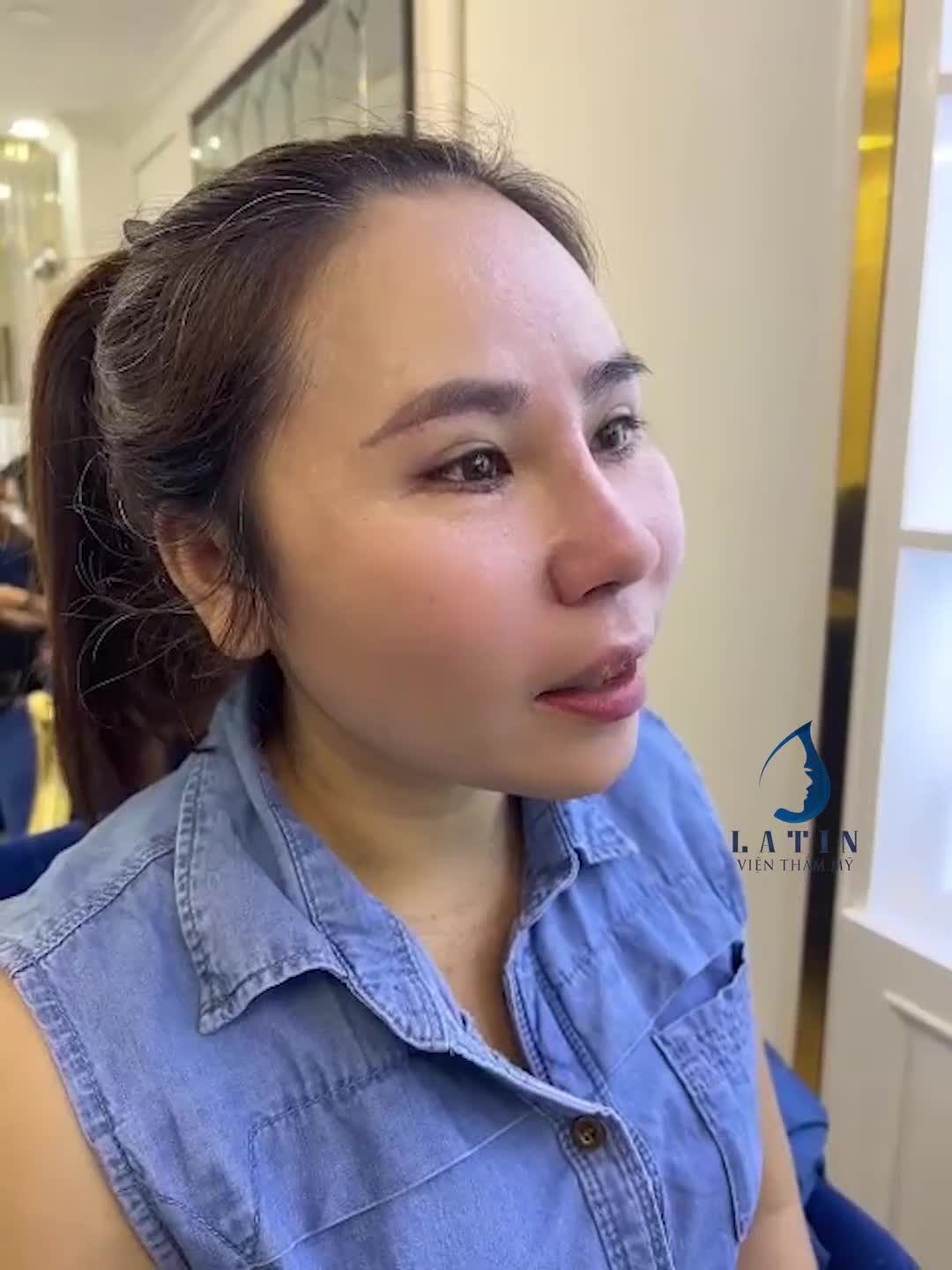 Mũi không đẹp đời không nể