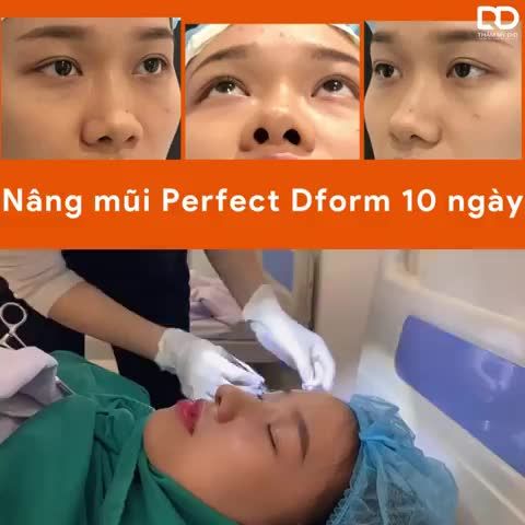 Thì ra...mùa Xuân...hoa nở là vì Nâng mũi Perfect Dform