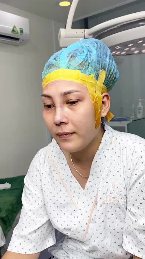 NÂNG MŨI CẤU TRÚC – KH Nguyễn Thị Hằng Chị Hằng đến với bác sĩ Hoạt để chỉnh sửa các khuyết điểm nguyên thủy