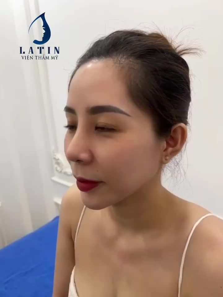 Mũi không đẹp đời không nể