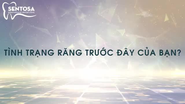 THAY ĐỔI RĂNG KÉM DUYÊN SAU 2 NĂM CHỈNH NHA MẮC CÀI