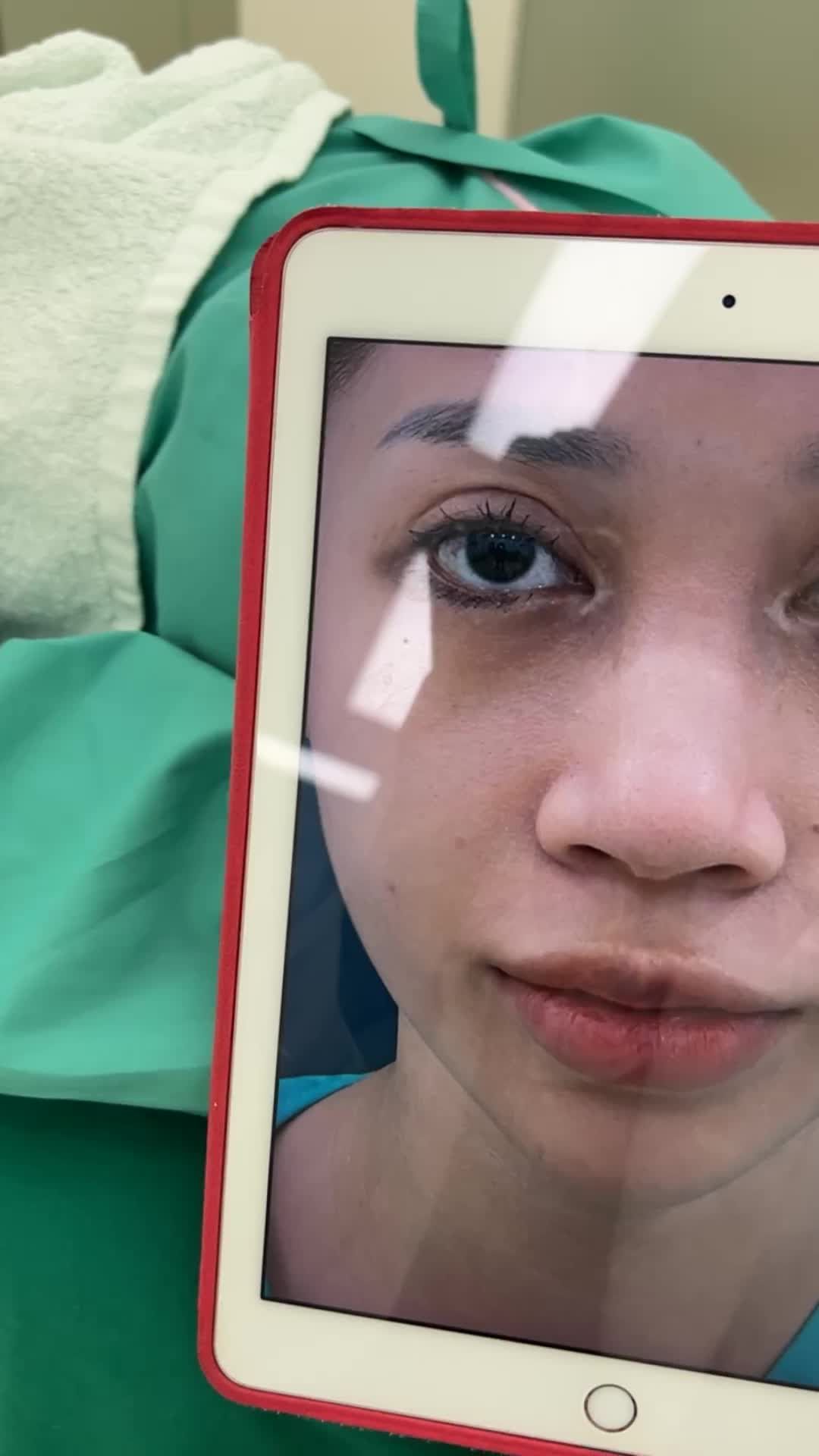 Case mũi cấu trúc vừa hoàn thành tại Viện