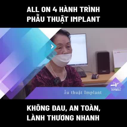 HÀNH TRÌNH PHẪU THUẬT CẮM TRỤ IMPLANT AN TOÀN, KHÔNG ĐAU