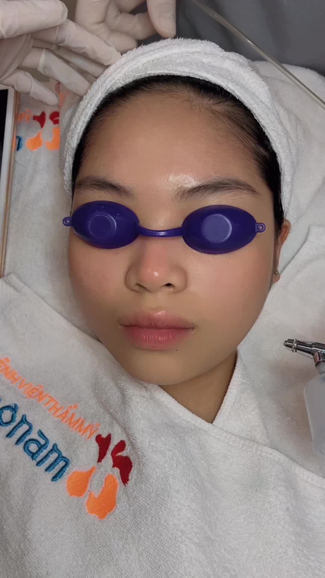 Hè đến  Mụn chính là điều khiến chúng ta khó chịu nhất