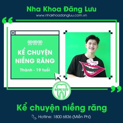 Niềng răng khớp cắn ngược & những trải nghiệm ngày đầu đeo niềng