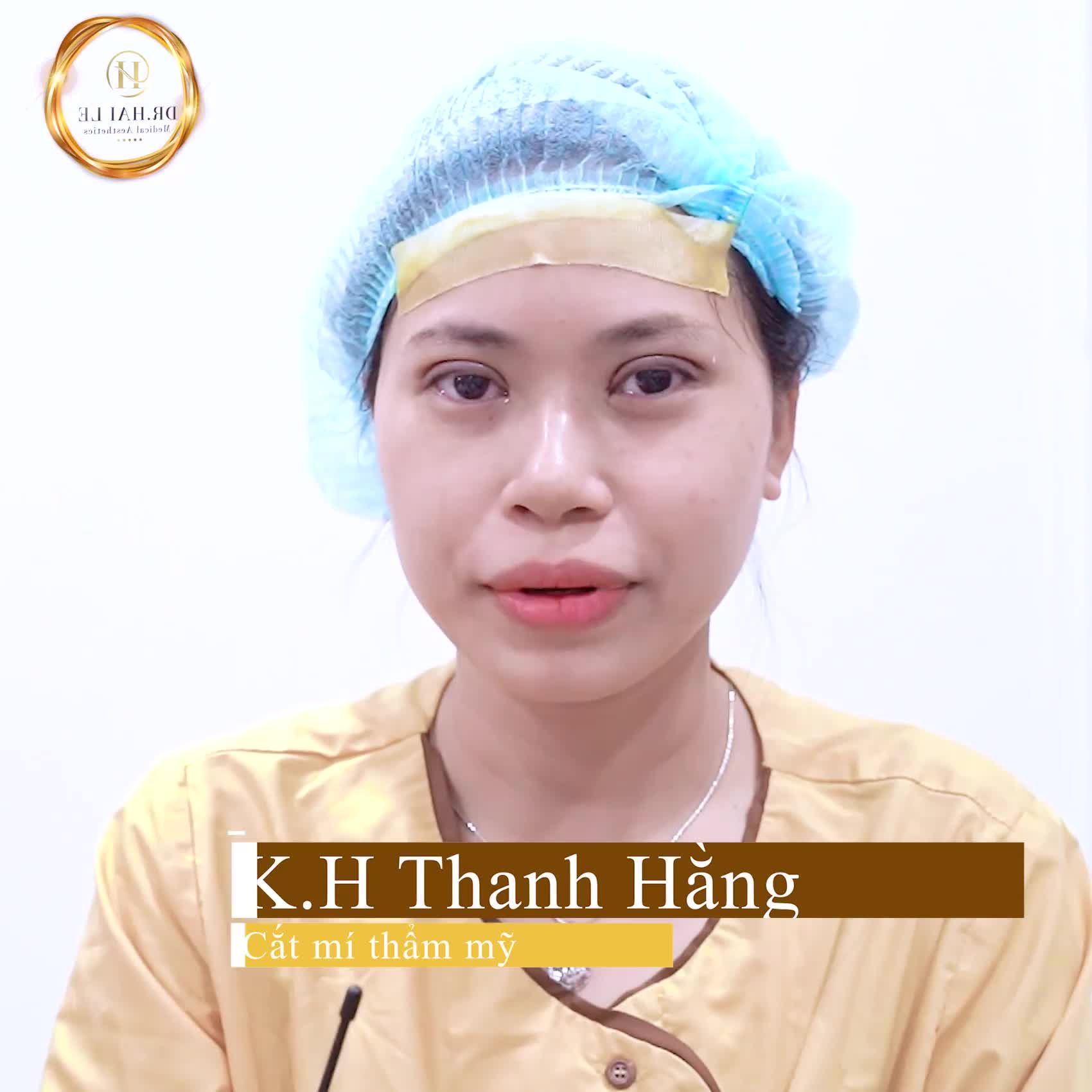 Bạn gái sau khi trải nghiệm dịch vụ cắt mí tại Dr.Hải Lê -Sài Gòn
