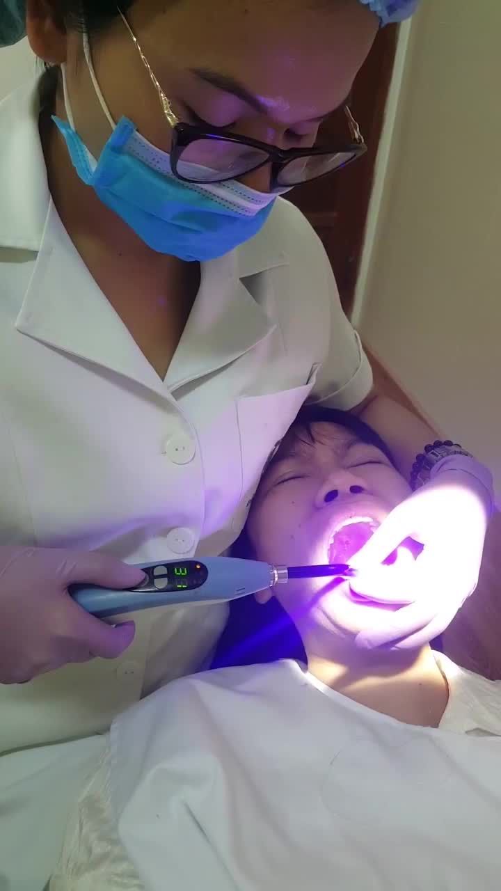 LẮP HOÀN THIỆN CA THẨM MỸ 16 RĂNG SỨ CERAMILL CAO CẤP