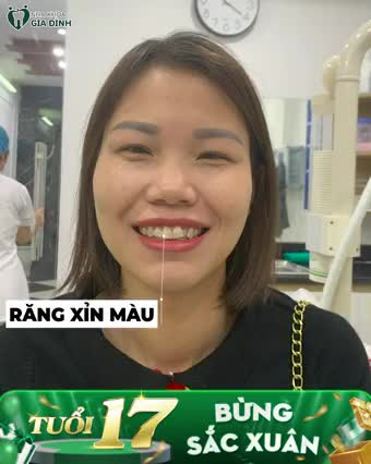 RĂNG TRẮNG NHƯ NGỌC - TÀI LỘC DỒI DÀO