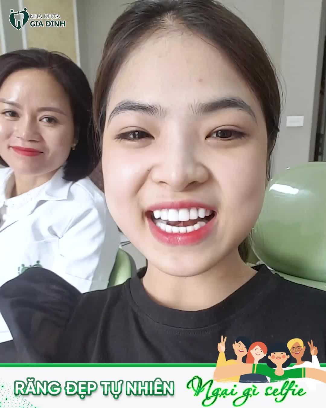 ĐÃ CÓ RĂNG ĐẸP - CHẲNG NGẠI SELFIE