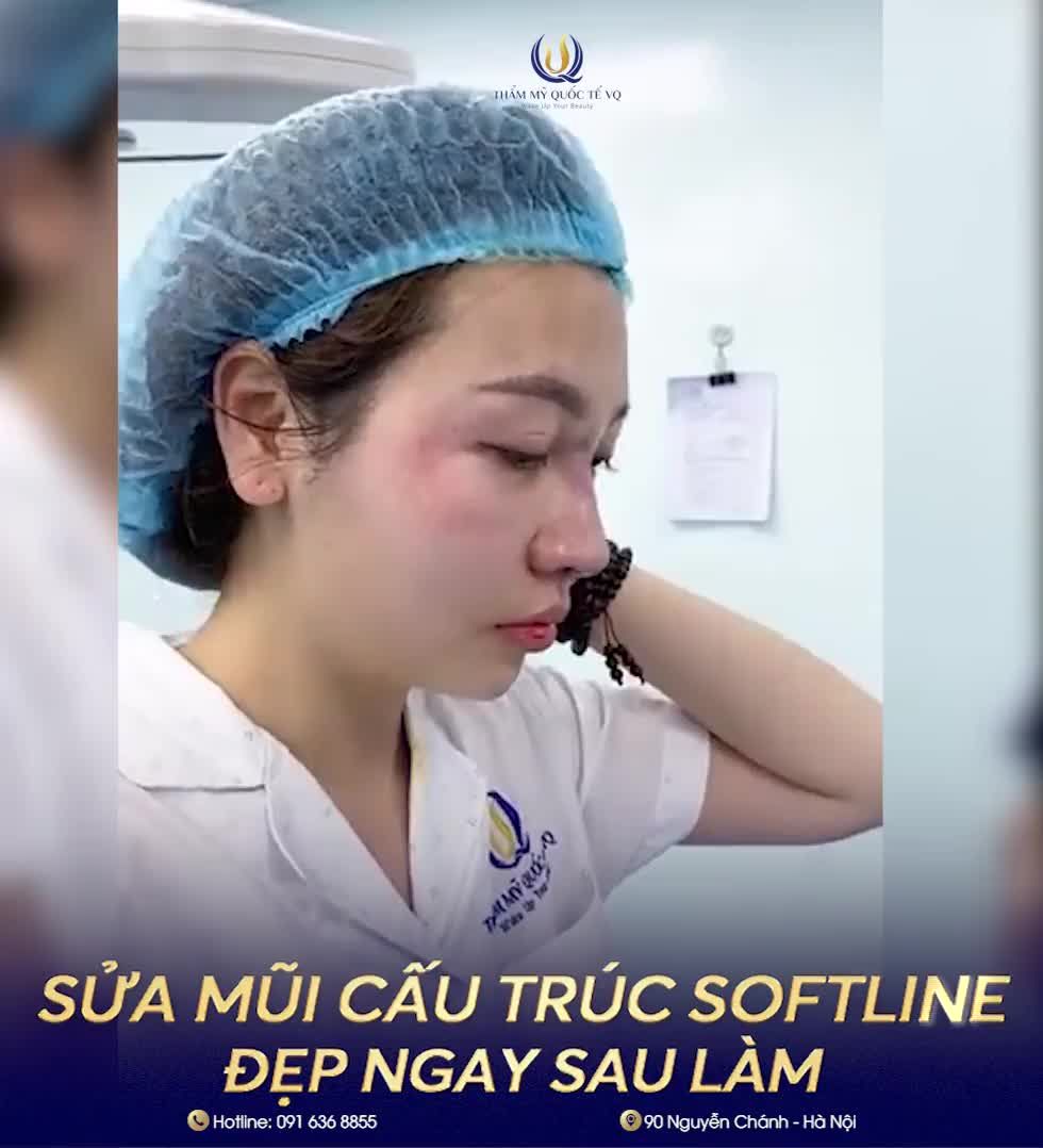 Dáng mũi đã hỏng 2 lần của Cô gái Hải Phòng