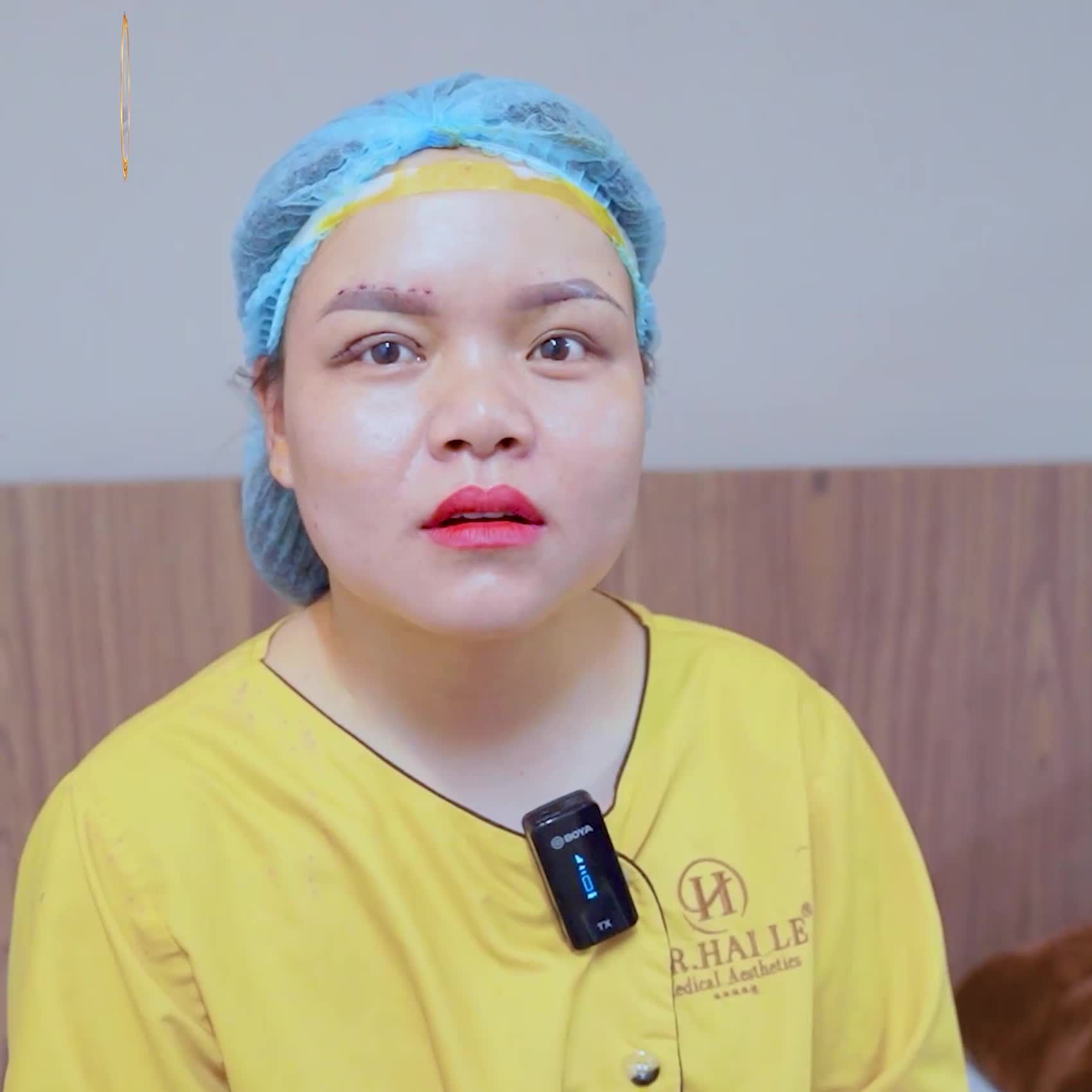 MÍ SỤP BẨM SINH KHÓ - CÓ DR.HẢI LÊ LO!!