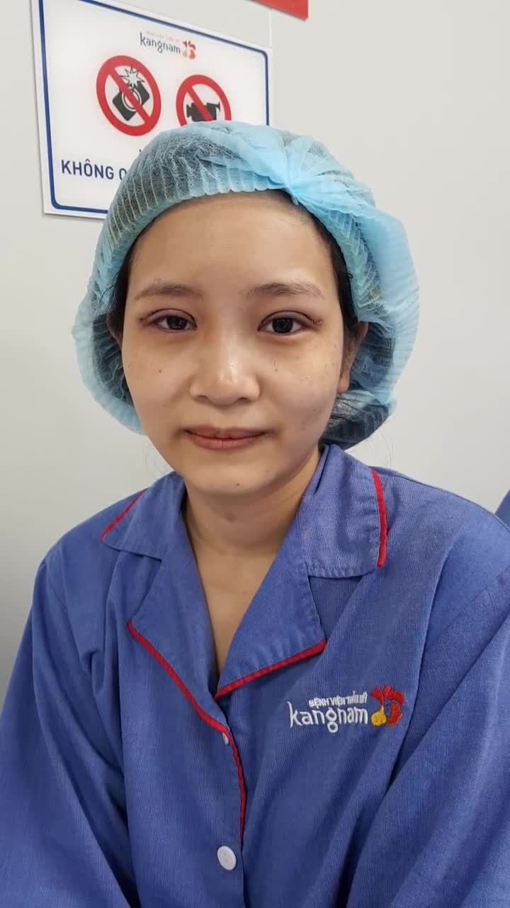 Xóa nỗi sợ CẮT MÍ đau sưng to sẹo