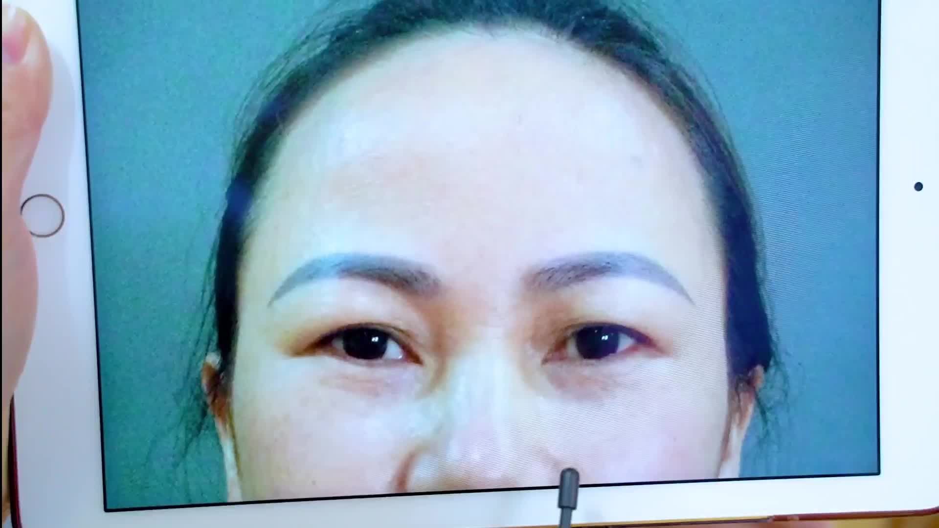 COMBO CẮT MÍ NÂNG CUNG MÀY - NÍU KÉO TUỔI XUÂN CHO ĐÔI MẮT TRẺ TRUNG