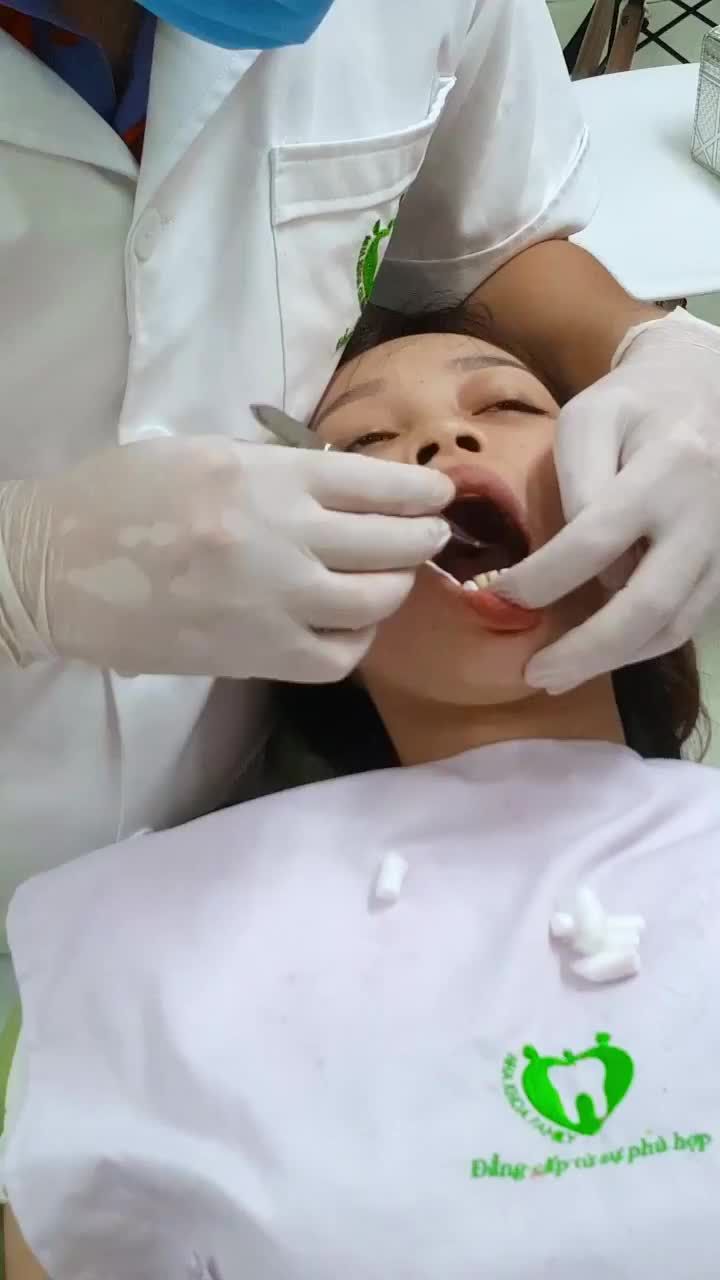 QUÁ TRÌNH GẮN CỐ ĐỊNH VENEER SỨ CAO CẤP CHO KH TẠI CS4