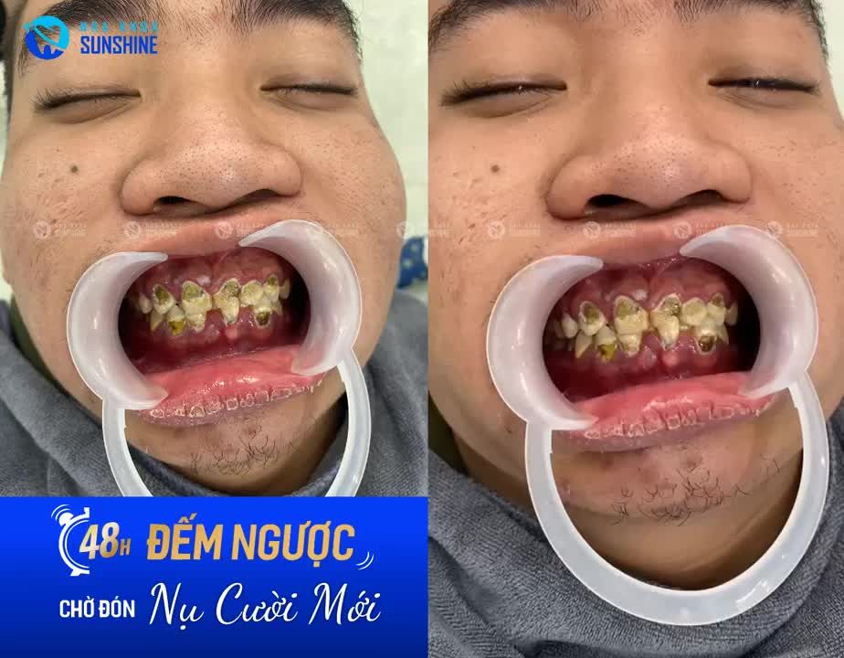 ĐẾM NGƯỢC, CHỜ ĐÓN NỤ CƯỜI MỚI CỦA KHÁCH HÀNG