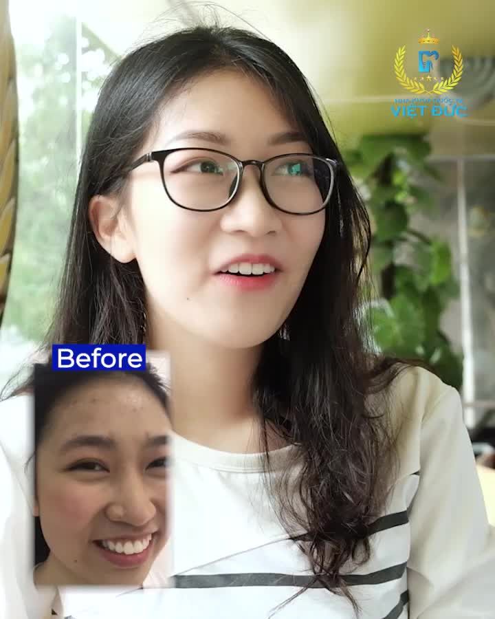 Review Niềng Răng tại Nha Khoa Quốc Tế Việt Đức