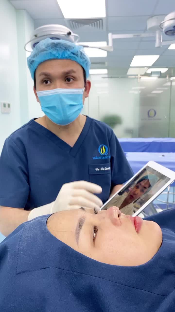 Kết quả Sửa mũi từng tiêm filler cách đây 3 năm
