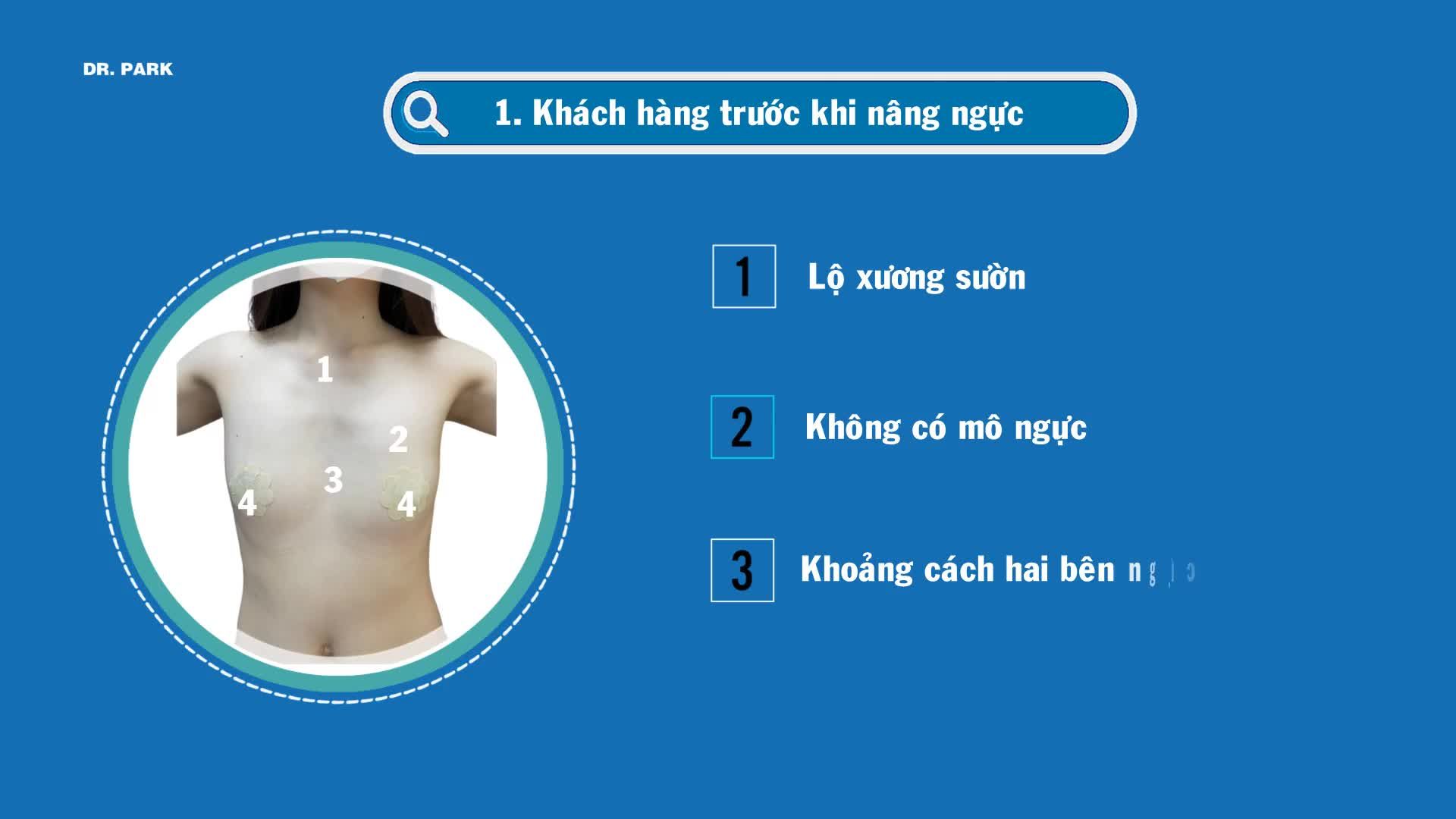 NÂNG NGỰC CHUẨN ĐẸP LÀ NHƯ THẾ NÀO