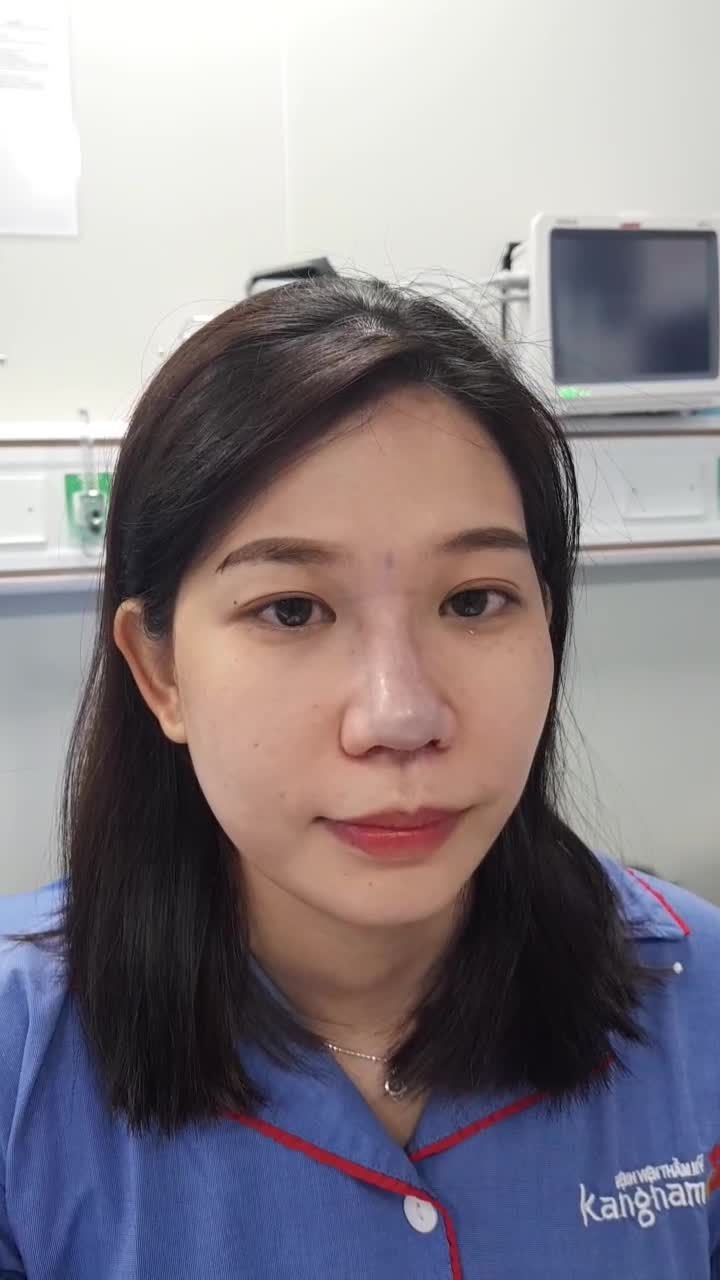 Lột xác dáng MŨI siêu đẹp sau 45 phút