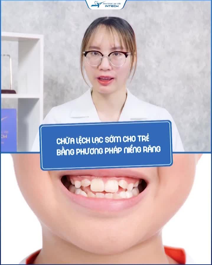 CHỮA LỆCH LẠC RĂNG SỚM CHO TRẺ BẰNG PHƯƠNG PHÁP NIỀNG RĂNG