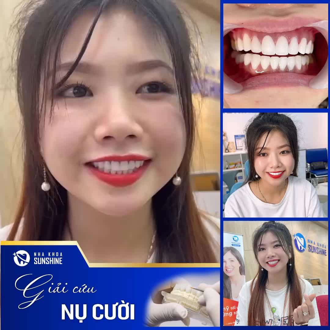 CÙNG SUNSHINE GIẢI CỨU NỤ CƯỜI