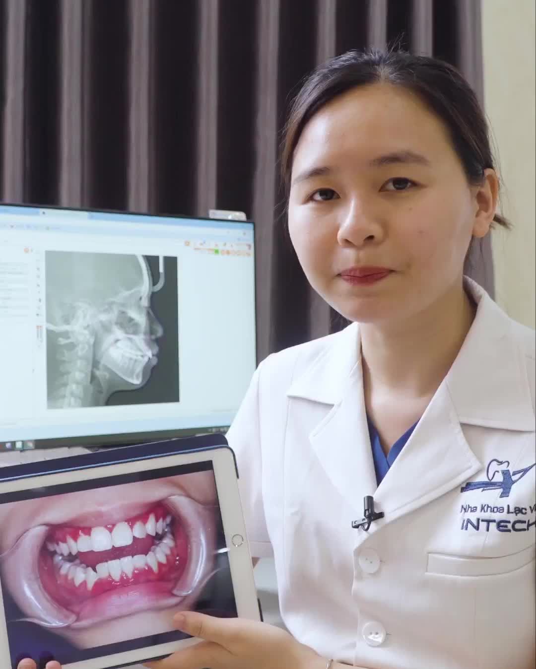 TƯ VẤN KẾ HOẠCH ĐIỀU TRỊ TRƯỜNG HỢP RĂNG CHEN CHÚC, KHẤP KHỂNH