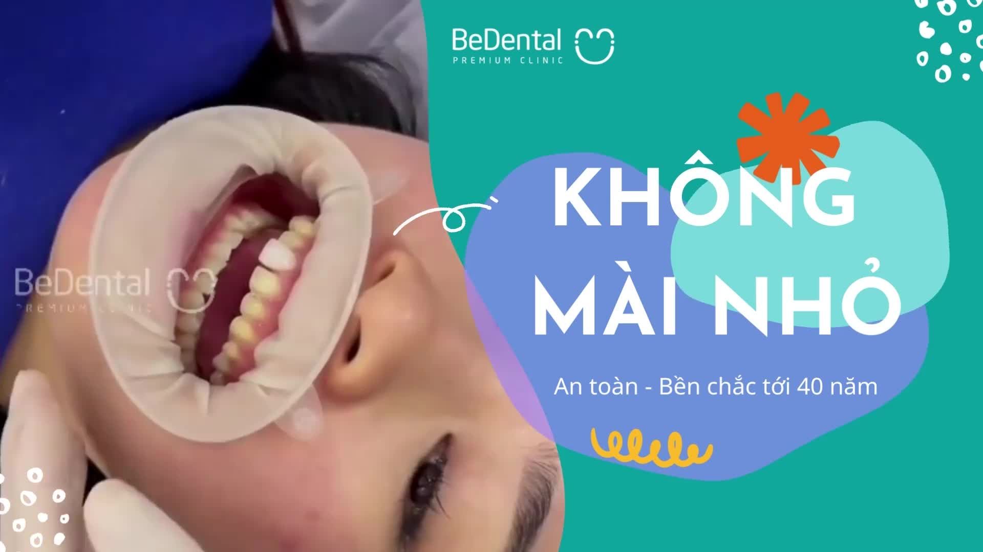 Làm răng sứ tại Bedental CAM KẾT KHÔNG MÀI NHỎ