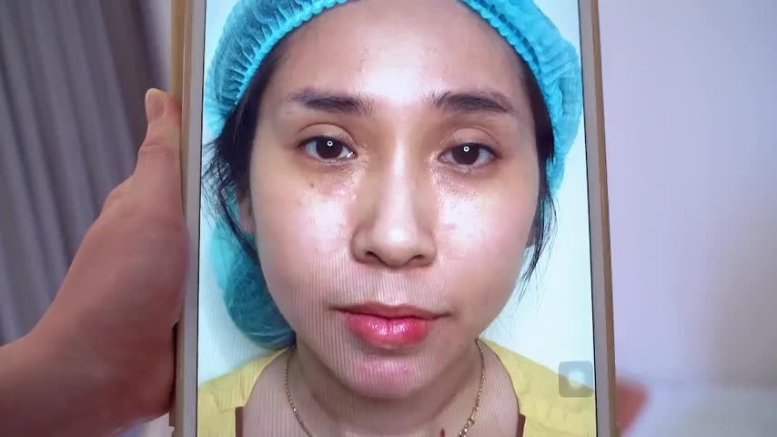 Mí mắt lỗi hỏng bạn đừng quá lo lắng hãy đến ngay Dr.Hải Lê để có giải pháp khắc phục bạn nhé