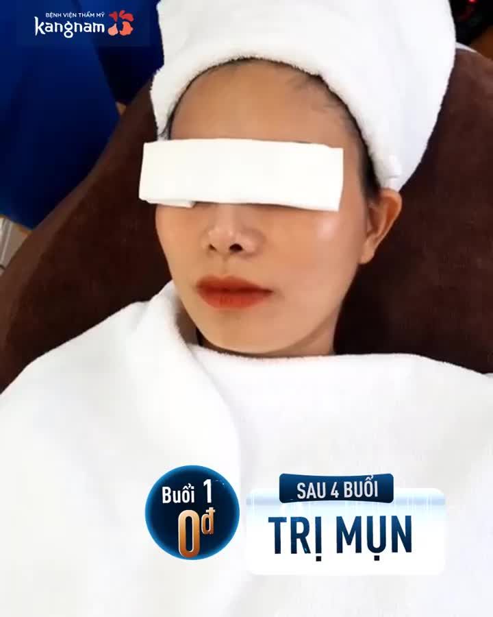 Quy trình chiếu ánh sáng ella sau khi lấy nhân mụn giúp da trắng sáng, giảm sưng đỏ, kích thích sự tăng trưởng collagen trong trị mụn De Acne
