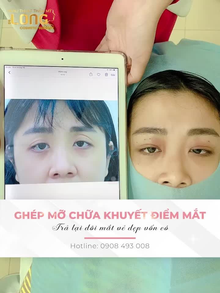 NGƯỢC CHIỀU LÃO HÓA ĐEM ĐÔI MẮT XINH ĐẸP QUAY VỀ KHÔNG CẦN PHẪU THUẬT VẪN TRẺ HÓA BẤT NGỜ, BÍ QUYẾT LÀ GÌ