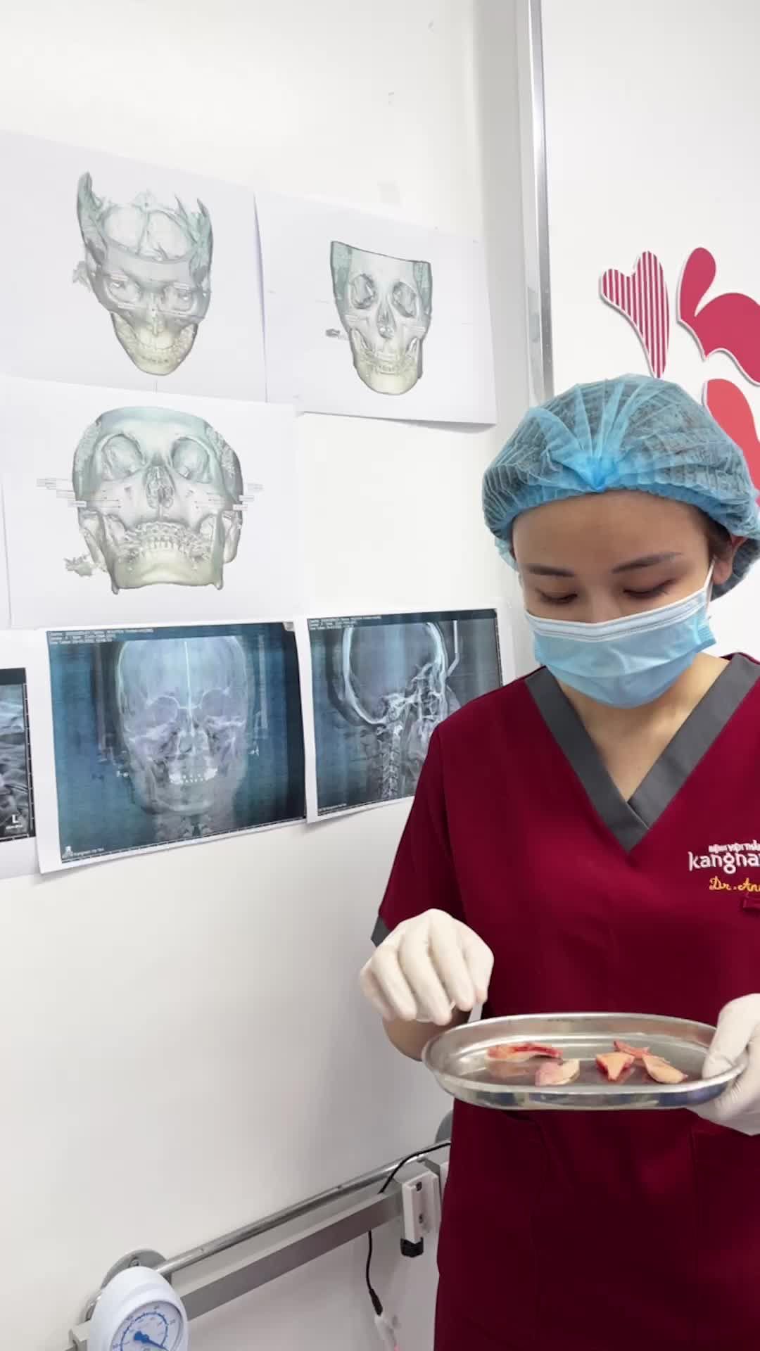 Gọt hàm - Trượt cằm - Hạ gò má cùng bác sĩ Annie Lê và ekip bác sĩ phẫu thuật chương trình Hành trình lột xác