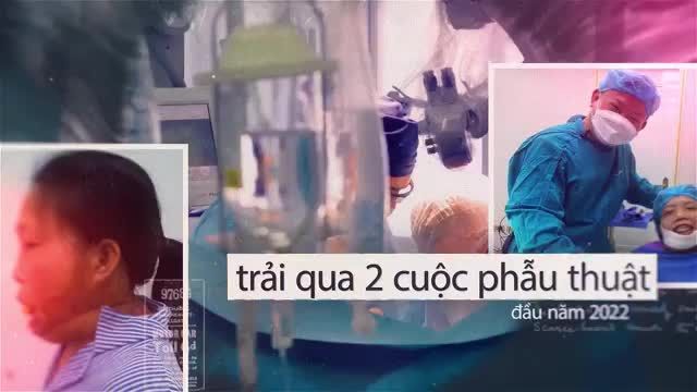 Chị Trần Thị Hoài - người phụ nữ 33 năm không mang gương mặt con người - do sự cố bị bỏng khi còn bé.