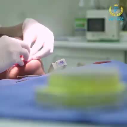 BỌC RĂNG SỨ NANO CERAMIC