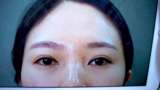 CẮT MÍ SAU 7 NGÀY MÀ CẢM THẤY NHẸ NHƯ KHÔNG...