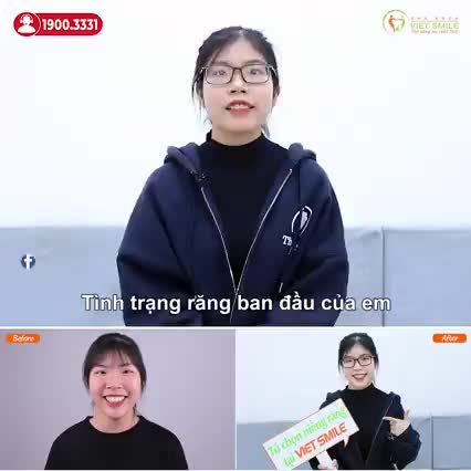 CẢM NHẬN TRONG QUÁ TRÌNH NIỀNG RĂNG